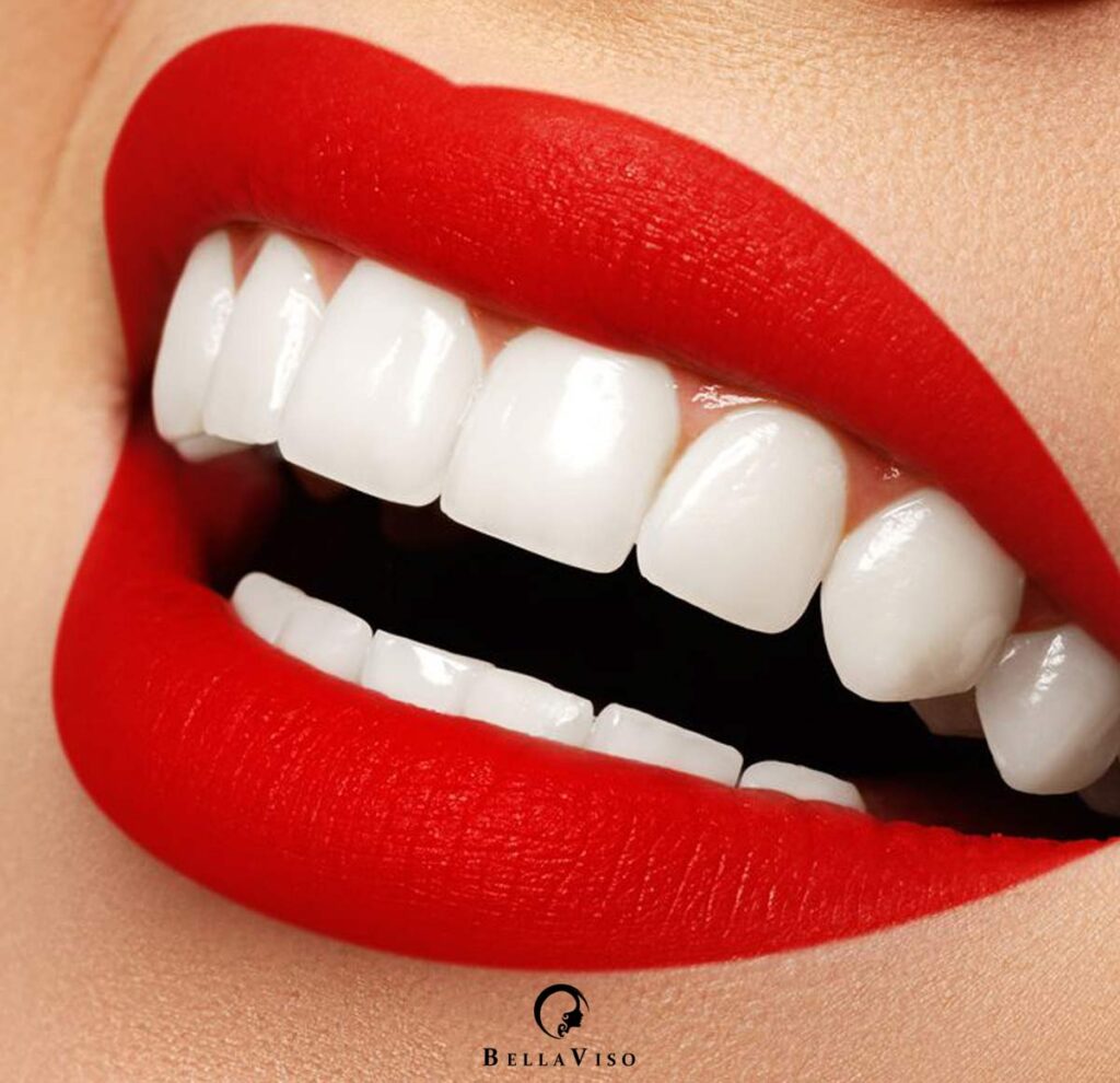 Best Teeth Cleaning Medical Center in Dubai